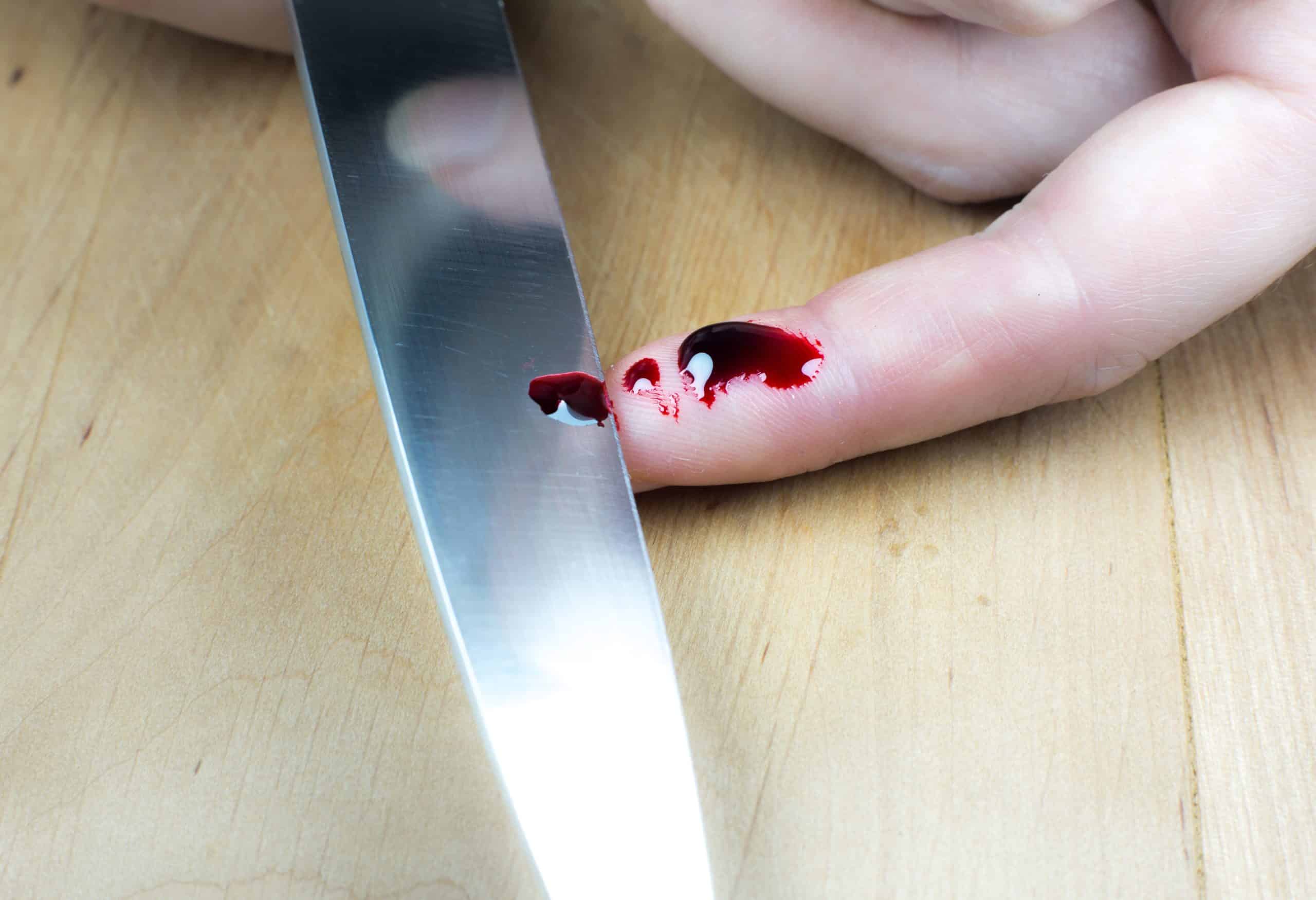 finger geschnitten schnittwunden vermeiden